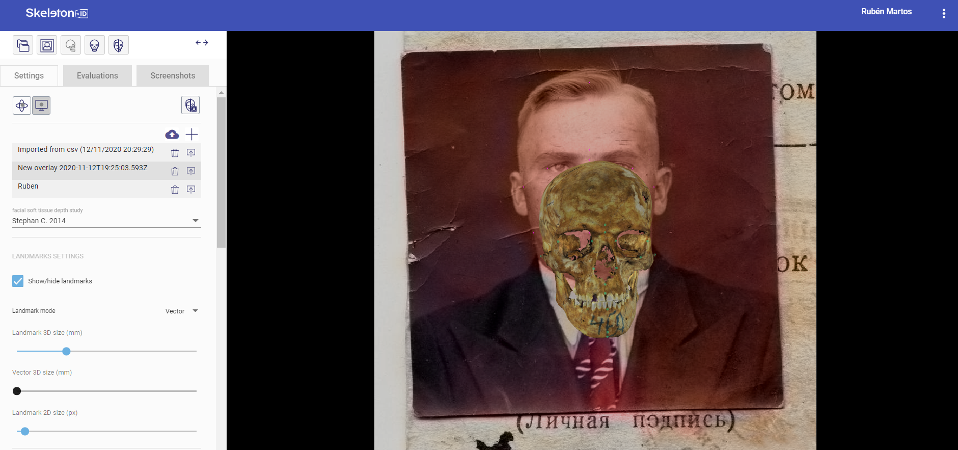 Skeleton·ID skull-face overlap scene